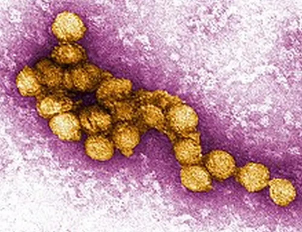 Ausl: West Nile, non abbassare la guardia